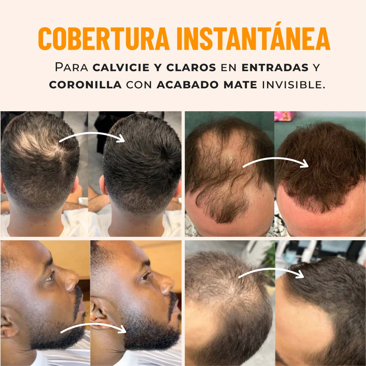 Türeno™ Polvo capilar cobertura invisible