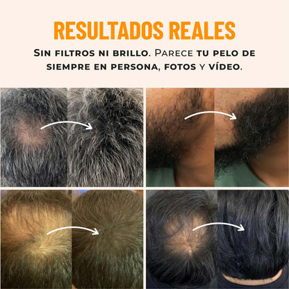 Türeno™ Polvo capilar cobertura invisible